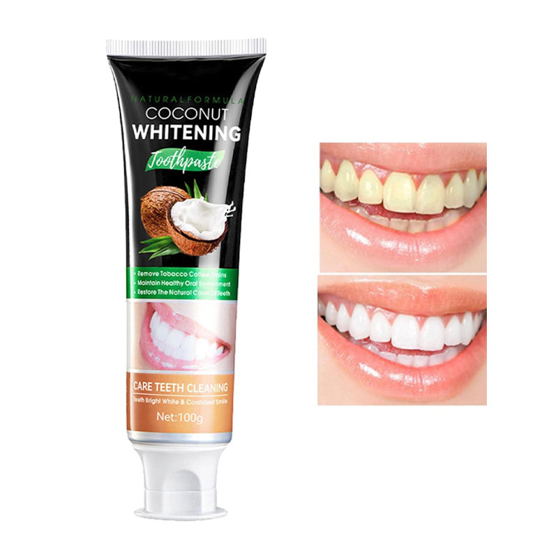 خمیر دندان سفید کننده نارگیلی سادور حجم 100 گرم