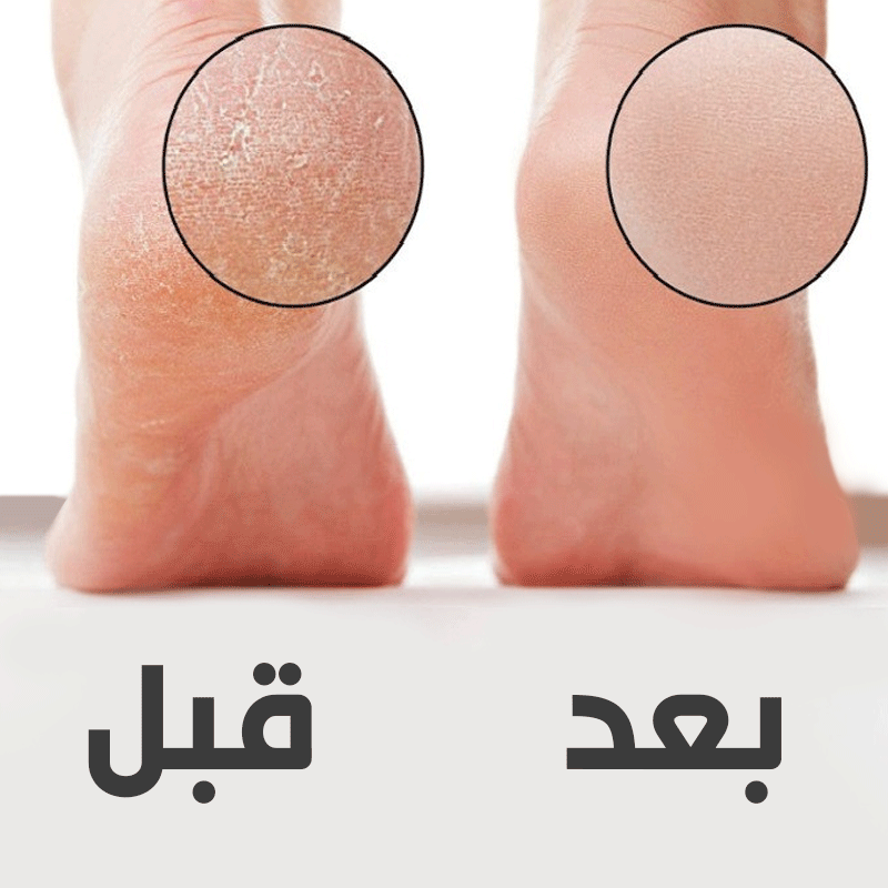 سوهان و رنده پا دستی سوییت کویین Sweet Queen