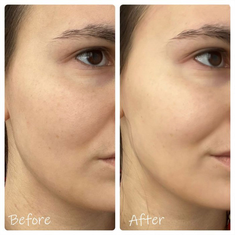 تونر روشن کننده ماداگاسکار Madagascar Brightening سنتلا Centella هیالو سیکا Hyalu-Cica اسکین SKIN 1004 حجم 210ml