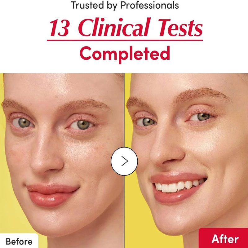 سرم روشن کننده قوی پوست ویتامین سی اکوال بری EqqualBerry مدل ILLUMINATING حجم 30ml