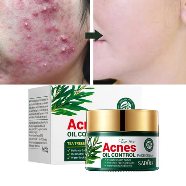 کرم کاسه ای ضدجوش درخت چای سبز سادور Sadoer - Image 2