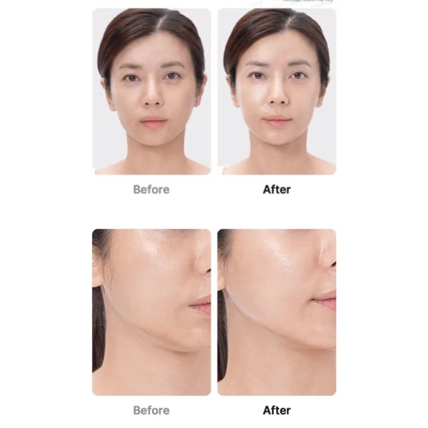 دستگاه جوانساز بوستر پرو مدی کیوب Medicube مدل AGE-R Booster Pro - Image 3