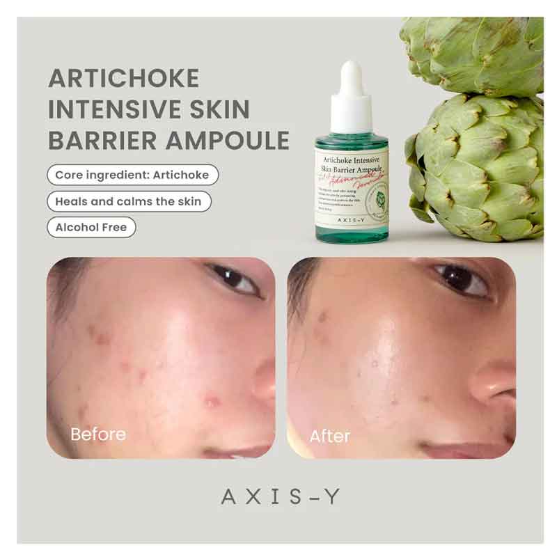 آمپول ضد جوش و تقویت سد دفاعی پوست اکسیس وای AXIS Y مدل Artichoke Intensive Skin Barrier Ampoule حجم 30ml