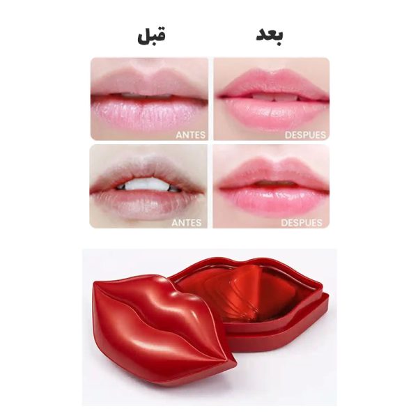 پک 20 عددی ماسک لب بیوآکوا Bioaqua - Image 2