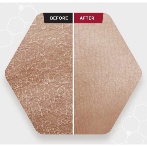 سرم پیلینگ و لایه بردار قوی زامبی بلادی Zombie Beauty اسکین SKIN 1004 حجم 30ml - Image 4