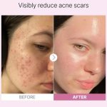 سرم نیاسینامید کوزارکس the Niacinamide 15 Cosrx حجم 20ml - Image 3