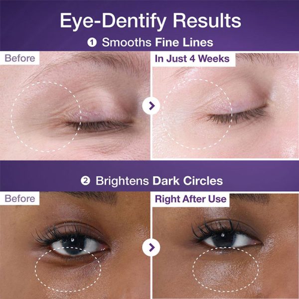 کرم دور چشم +NAD و رتینول شماره 9 No.9 Retinol نامبوزین NUMBUZIN ضد چروک و روشن کننده Volumetox Eye Cream حجم 10ml - Image 3