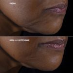 پک 3 عددی ضد چروک کلینیک Clinique مدل Smart Clinical Repair - Image 3