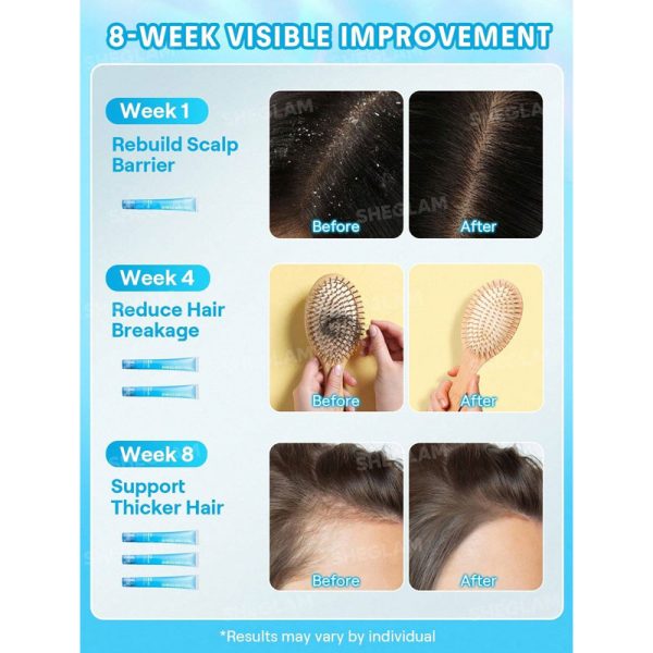 سرم خنک‌ کننده و تقویت کننده پوست سر Ice Revive Scalp Serum شیگلم Sheglam - Image 4