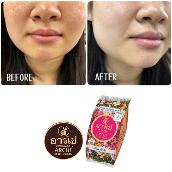 کرم روشن کننده و ضد لک arche - Image 2