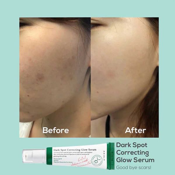 سرم ضد لک و روشن کننده اکسیس وای Axis Y مدل Dark Spot Correcting Glow Serum حجم 50ml