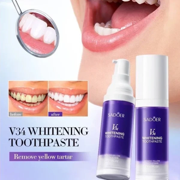 ژل سفیدکننده دندان سادور مدل V34 حجم 60 میلی لیتر - Image 2