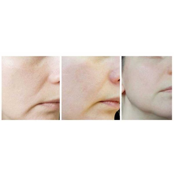 کرم مرطوب کننده چند منظوره امبریولیس Embryolisse مدل Lait Creme Concentre حجم 75ml