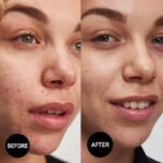 ژل شستشوی ضد جوش سالیسیلیک اسید اینکی لیست The INKEY مدل List Salicylic Acid Cleanser حجم 150ml