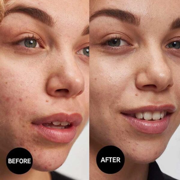 ژل شستشوی ضد جوش سالیسیلیک اسید اینکی لیست The INKEY مدل List Salicylic Acid Cleanser حجم 150ml