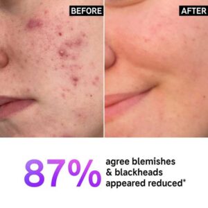 ژل شستشوی ضد جوش سالیسیلیک اسید اینکی لیست The INKEY مدل List Salicylic Acid Cleanser حجم 150ml