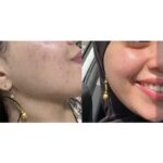 تونر ضد جوش و آبرسان 30 روزه میراکل سام بای می Some By Mi مدل AHA BHA PHA 30 Days Miracle Toner حجم 150ml