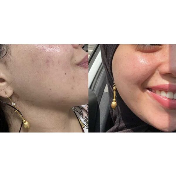 تونر ضد جوش و آبرسان 30 روزه میراکل سام بای می Some By Mi مدل AHA BHA PHA 30 Days Miracle Toner حجم 150ml