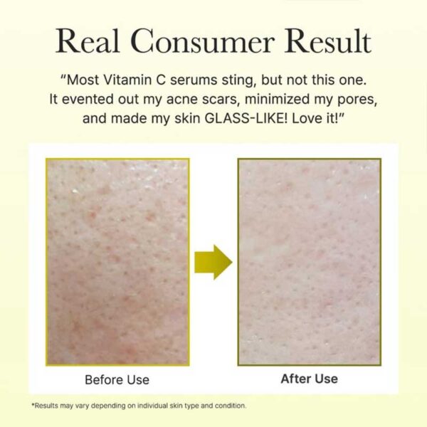 سرم روشن کننده و مرطوب کننده حاوی ویتامین C آرنسیا Arencia مدل Vitamin C Booster Shot حجم 30mlسرم روشن کننده و مرطوب کننده حاوی ویتامین C آرنسیا Arencia مدل Vitamin C Booster Shot حجم 30ml