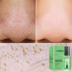 چسب ضد جوش سر سیاه بینی لنبنا مدل Blackhead Remover Mask حجم 17ml