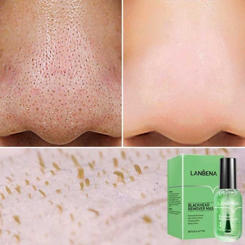 چسب ضد جوش سر سیاه بینی لنبنا مدل Blackhead Remover Mask حجم 17ml