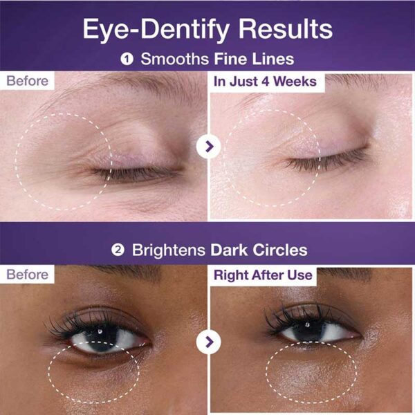 کرم دور چشم ضد چروک و روشن کننده نامبوزین Numbuzin مدل NAD+ Retinol Volumetox حجم 10ml