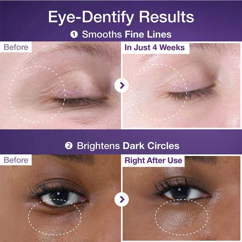 کرم دور چشم ضد چروک و روشن کننده نامبوزین Numbuzin مدل NAD+ Retinol Volumetox حجم 10ml